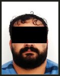 جنایت هولناک مرد یک‌پا با شلیک‌ کلاشینکف | ۳ جوان در خون خود غلطیدند + عکس