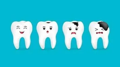 چگونه از پوسیدگی دندان جلوگیری کنیم؟